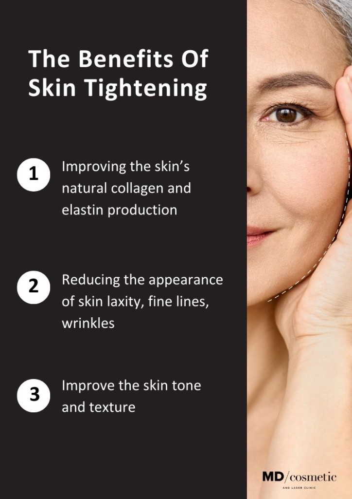 Benefits of skin tightening
