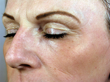 Rejuvenate your skin