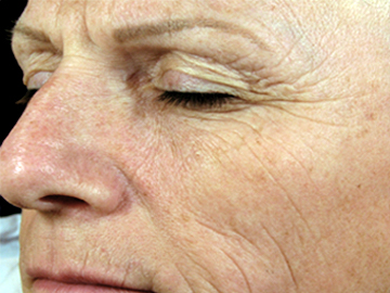 Rejuvenate your skin
